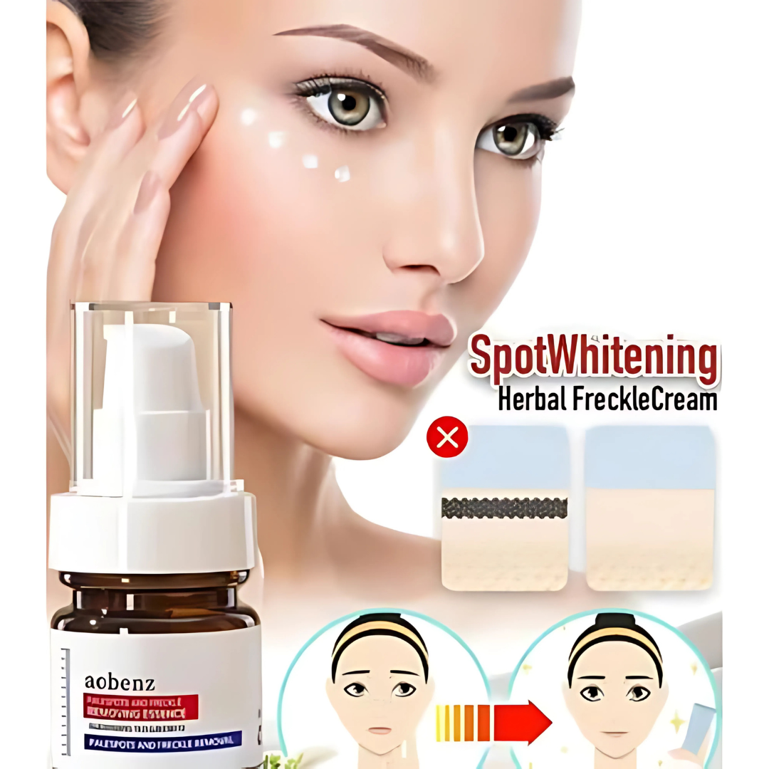 🔥Vitamin C Whitening Freckles Face Cream Remove Melasma Dark Spots Lighten Melanin