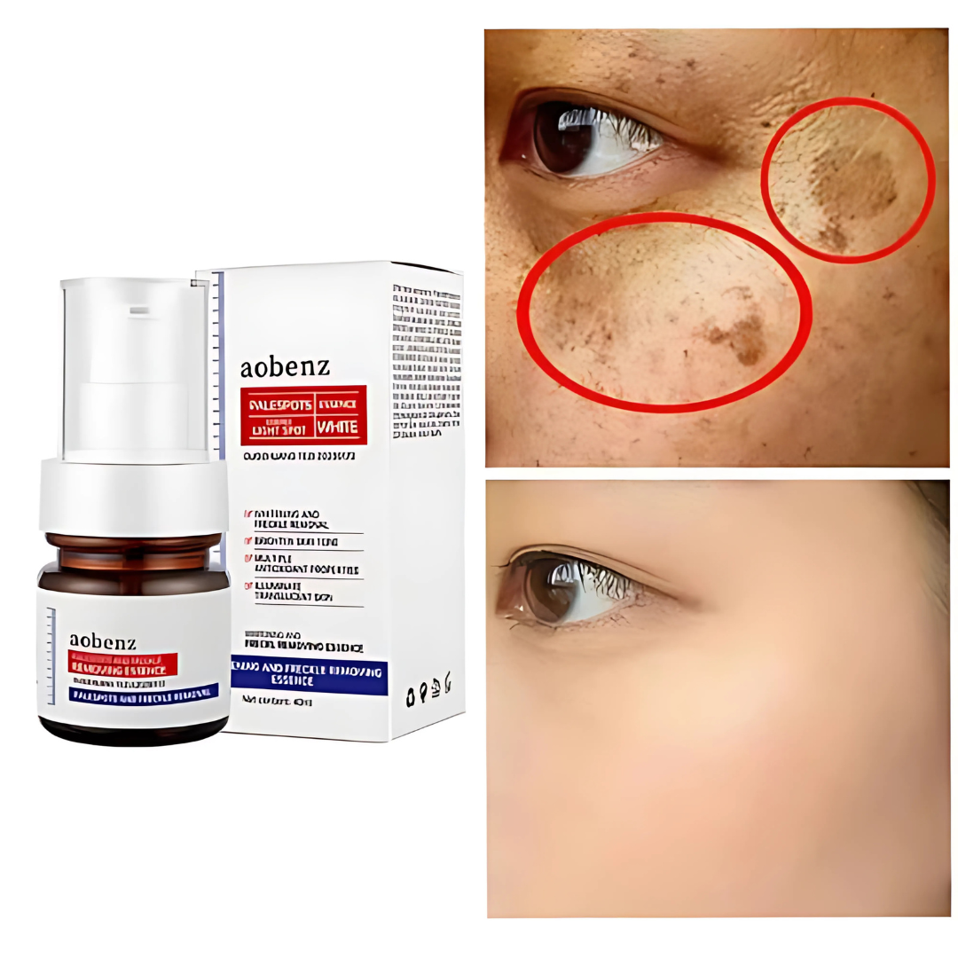 🔥Vitamin C Whitening Freckles Face Cream Remove Melasma Dark Spots Lighten Melanin