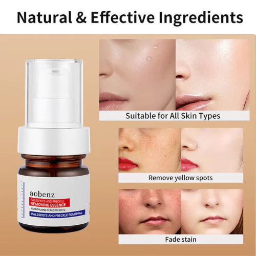 🔥Vitamin C Whitening Freckles Face Cream Remove Melasma Dark Spots Lighten Melanin